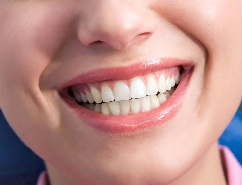 Gum-Contouring-reshaping gum disease