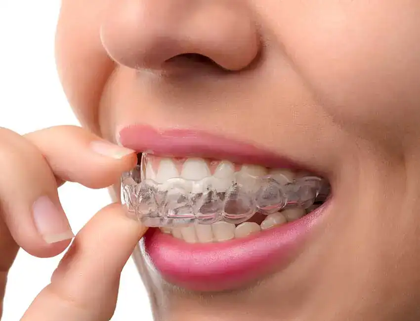 TMD Treatment at The Smile Spa