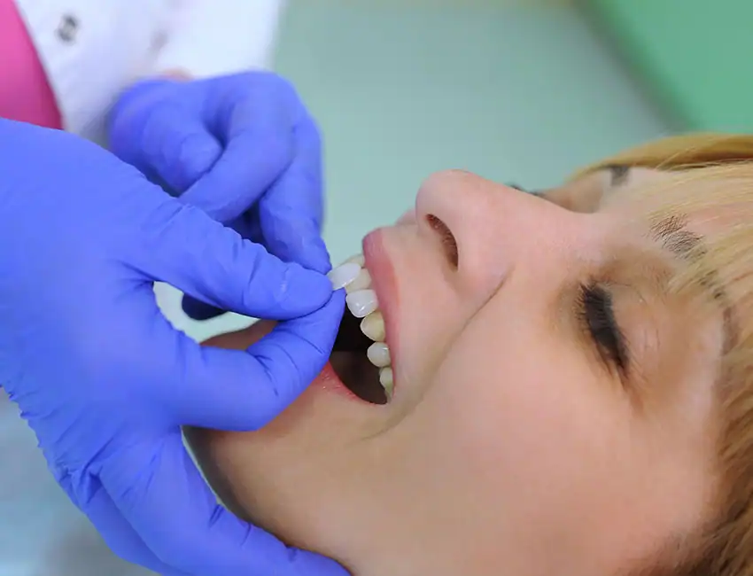 Patient getting dental veneers in Agoura Hills, CA