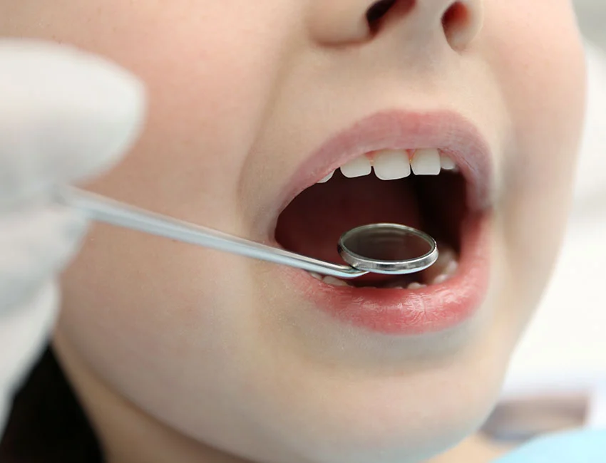 Child getting dental checkup in Oxnard, CA