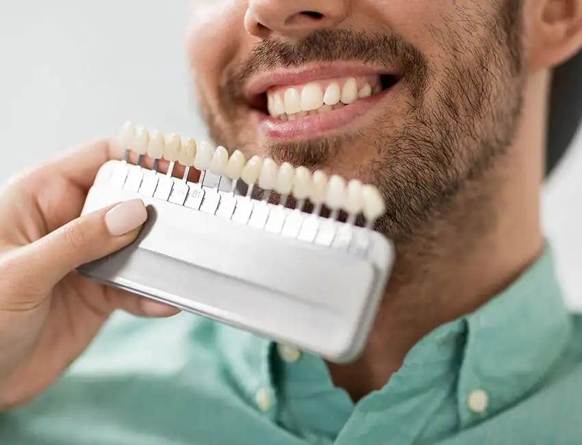 Teeth whitening