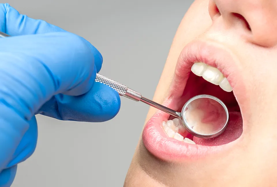 Dental Cleaning and Examinations at The Smile Spa in Agoura Hills, CA — How Routine Dental Cleanings Help With Gum Health