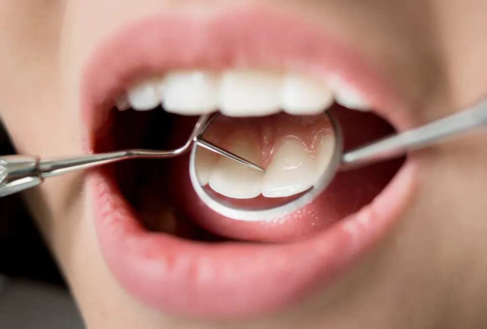 Dental Exams & X-Rays in Agoura Hills, CA