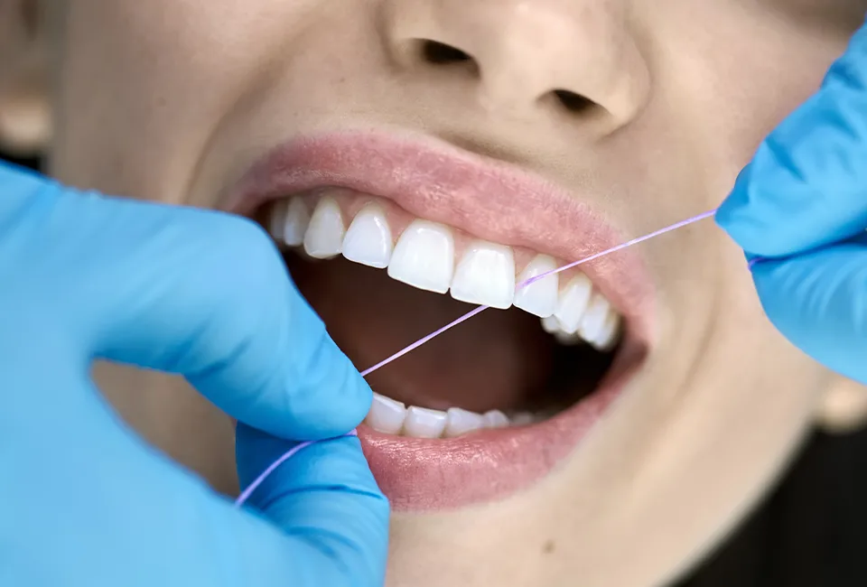 Dental Cleaning and Examinations at The Smile Spa in Agoura Hills, CA — General Dentistry: What to Expect During a Teeth Cleaning