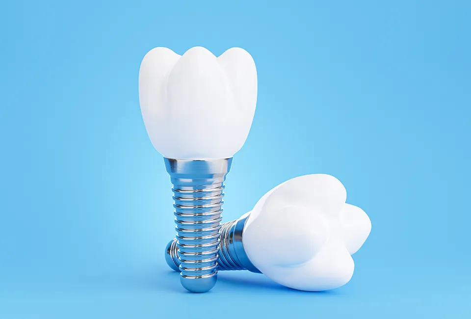dentistry-images (9) (1) implants