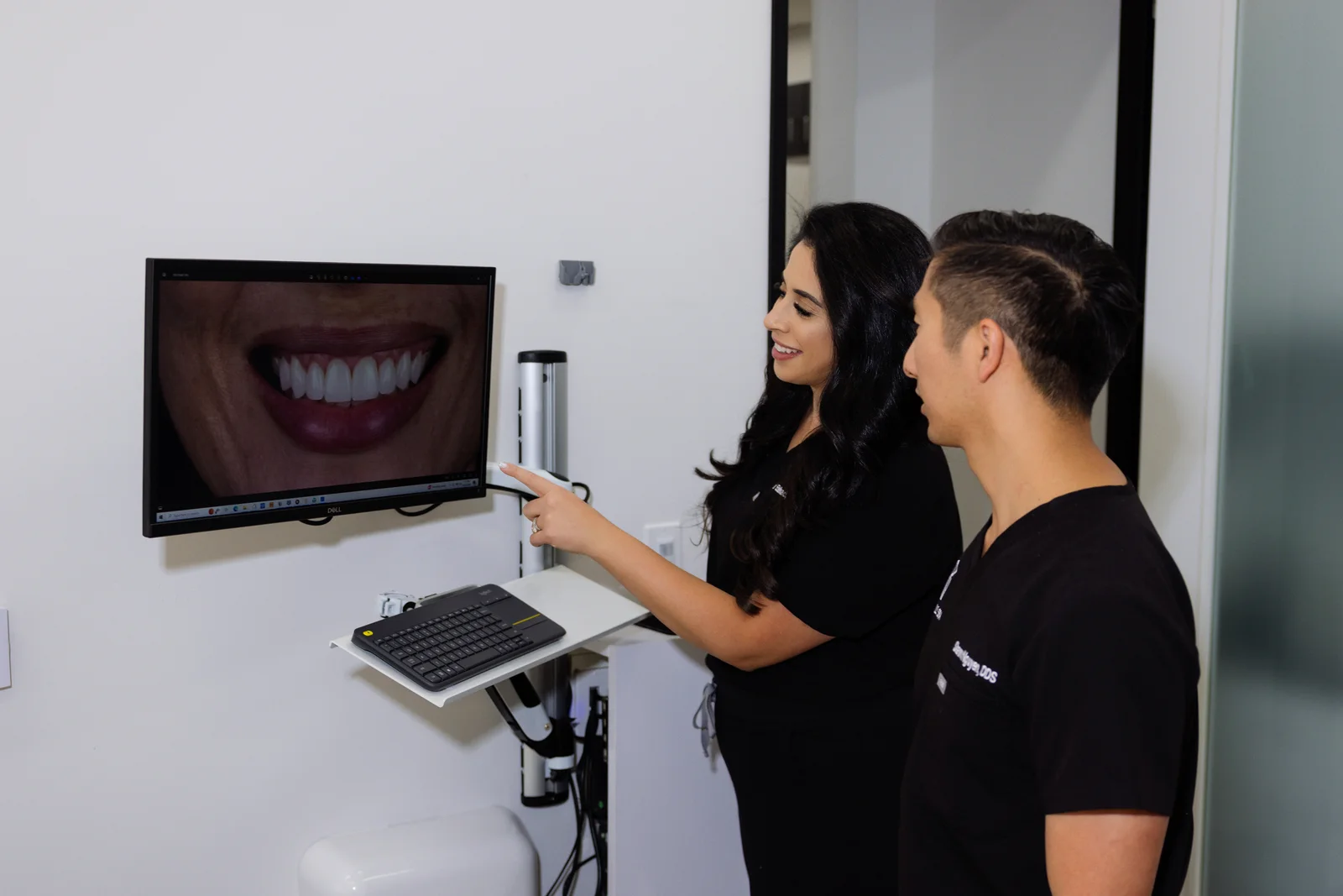 Gum Contouring at The Smile Spa