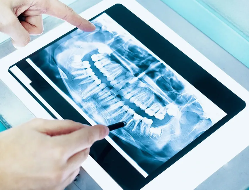 Dental Technology at The Smile Spa in Agoura Hills, CA — Advanced Dental Technology: Modern Solutions for Better Care