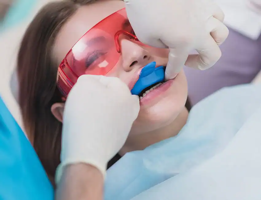 Fluoride Treatments at The Smile Spa
