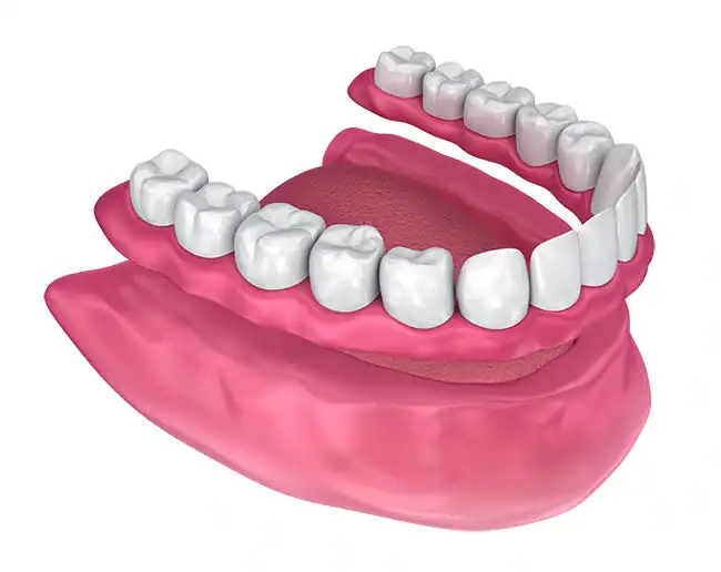 Adjusting to New Dentures at The Smile Spa in Agoura Hills, CA — Timeline for Adjusting to New Dentures