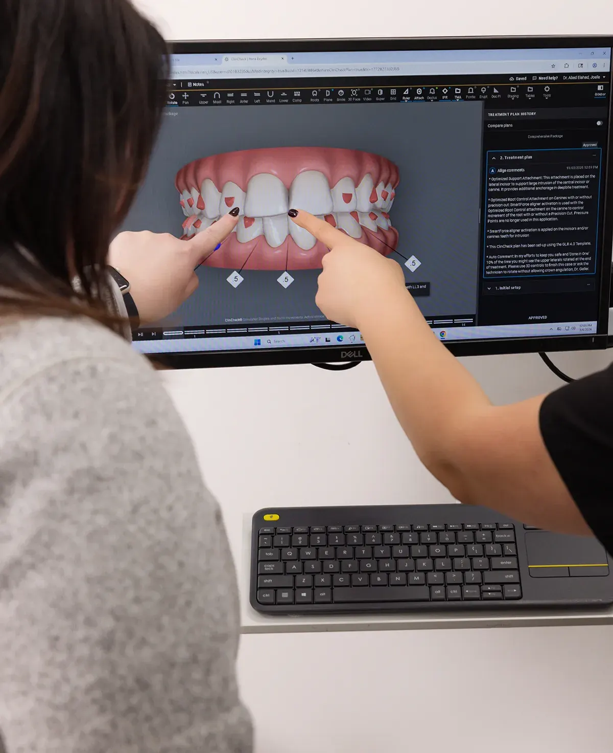 A dentist walking a patient through her personalized 3D treatment plan at The Smile Spa