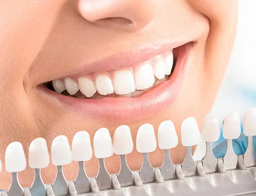 Patient with couple shade whiter tooth after teeth whitening treatment