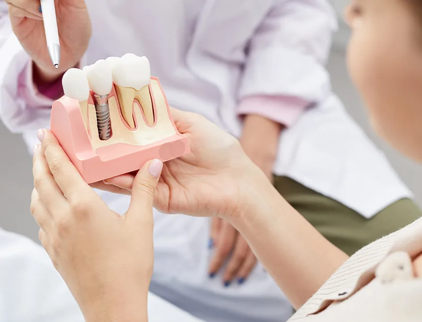 Dental Implants at The Smile Spa in Agoura Hills, CA — How Many Years Will a Dental Implant Hold Up?