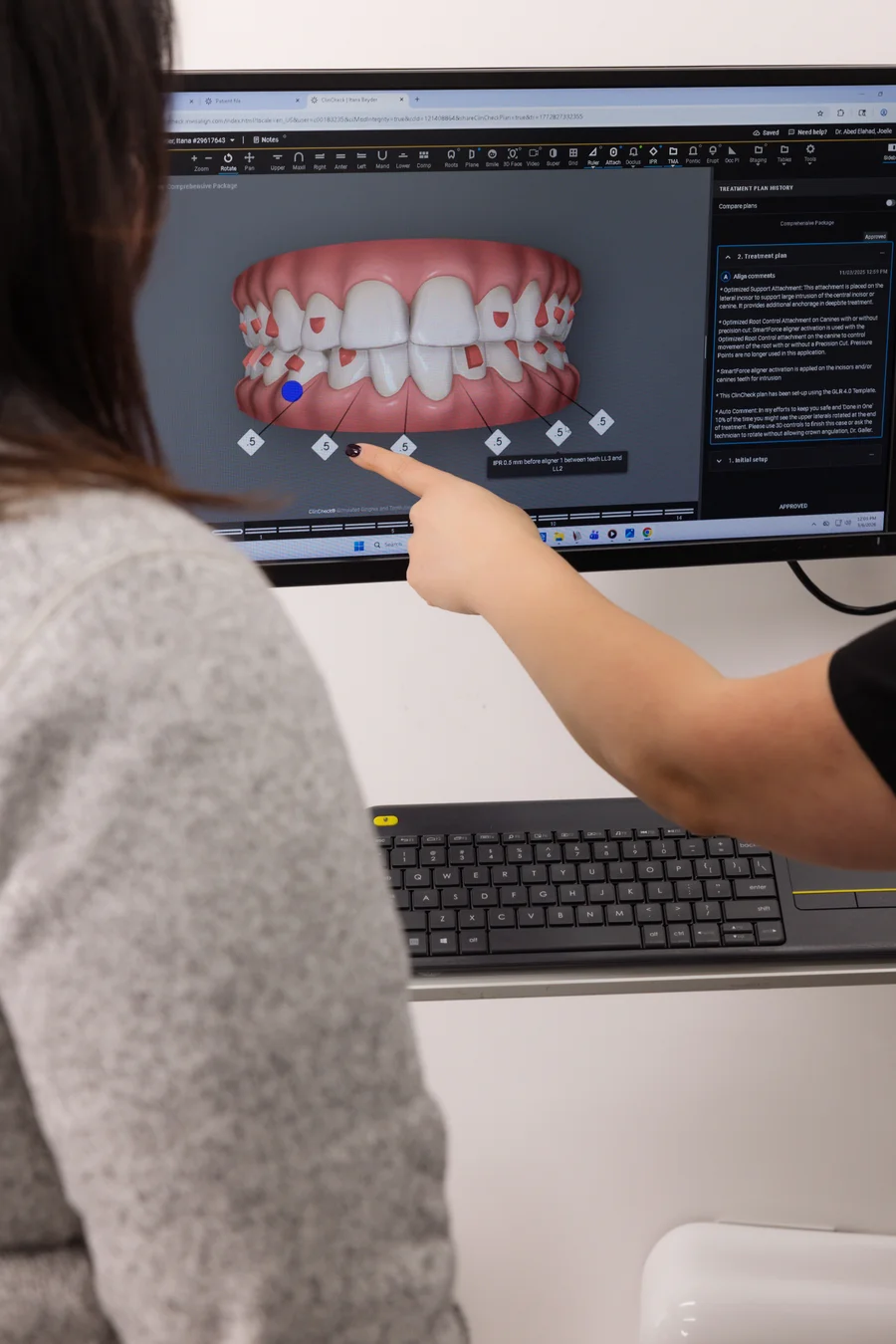 Cosmetic Crowns at The Smile Spa