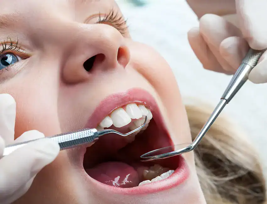 Dental Sealants in Agoura Hills, CA