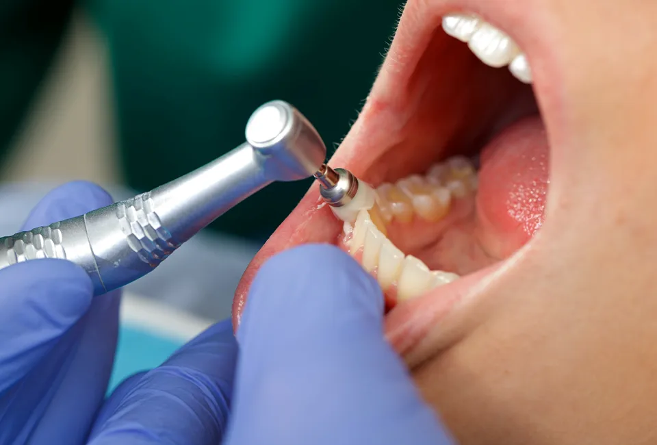 Dental Cleaning and Examinations at The Smile Spa in Agoura Hills, CA — Do I Really Need to See The Dentist Twice Per Year?