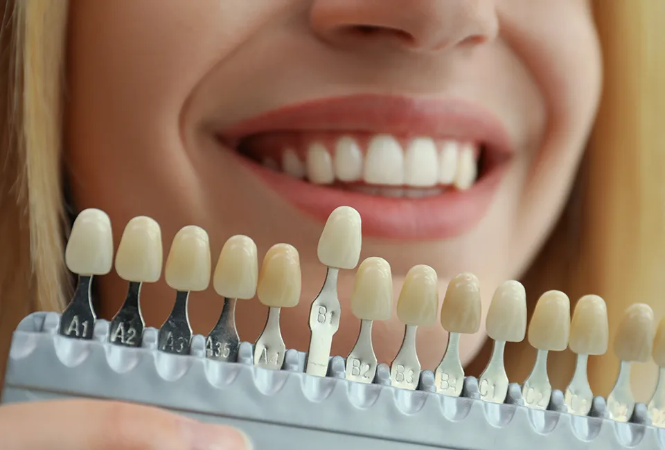 Zoom!® Whitening at The Smile Spa