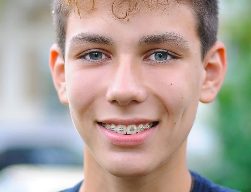 Single-Tooth Replacement