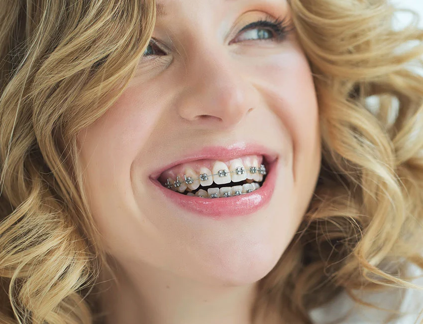 Smiling patient with braces