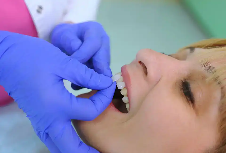 Composite Veneers in Agoura Hills, CA