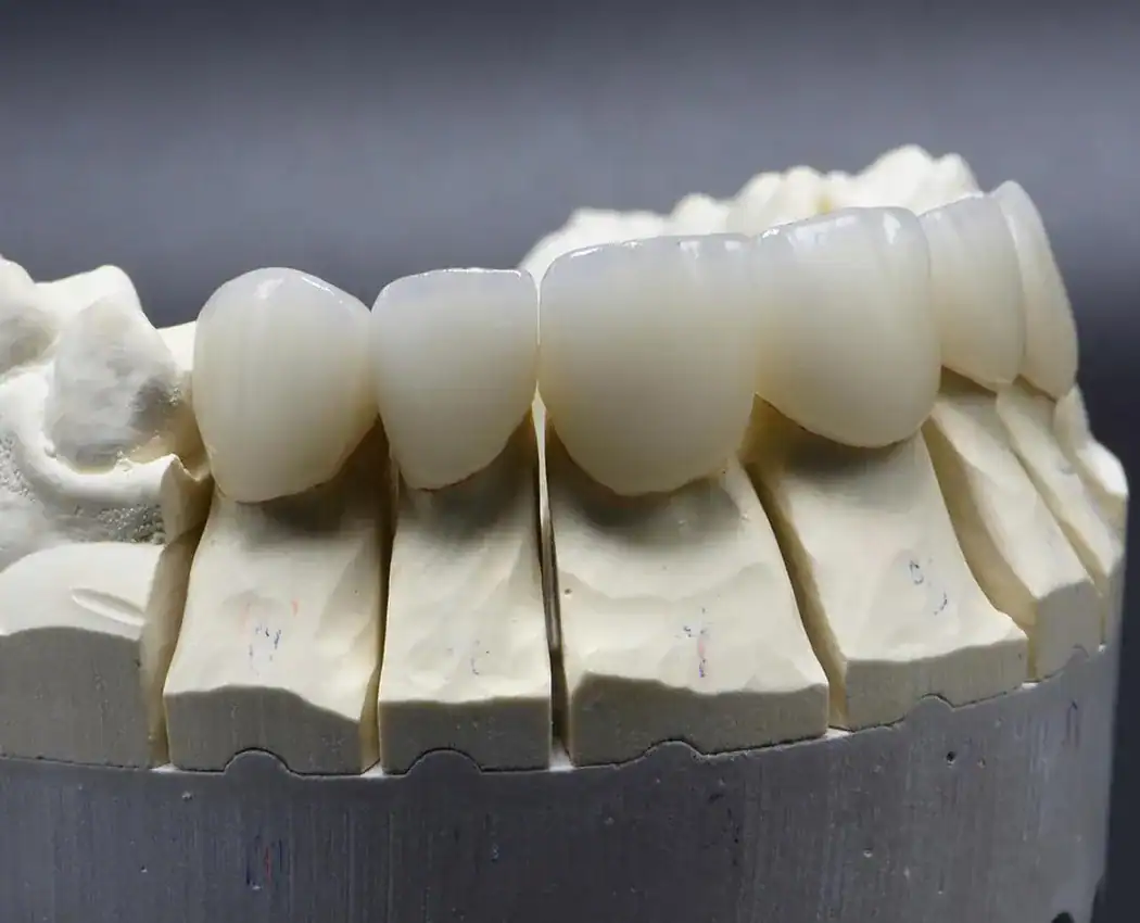 Cosmetic Dentistry at The Smile Spa